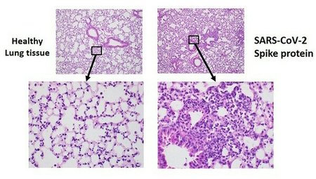 lungengewebe-corona-spikeprotein.jpg